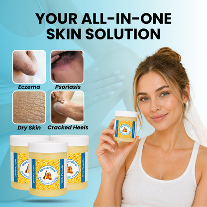 Steriod Free Balm For Eczema & Psoriasis